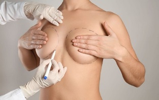 μεθόδους αύξησης του μαστού με χειρουργική επέμβαση