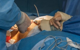 πώς γίνεται η χειρουργική επέμβαση αύξησης του μαστού